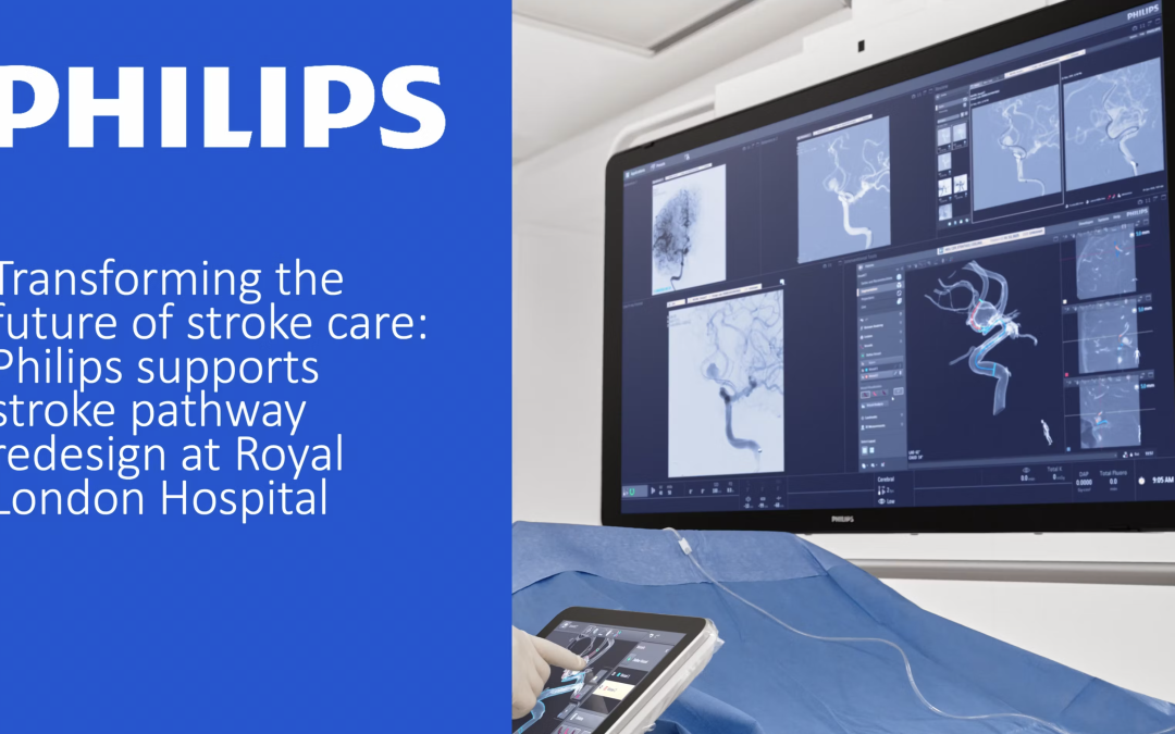 Redesigning Stroke Care Pathways: A Collaborative Approach at Royal London Hospital